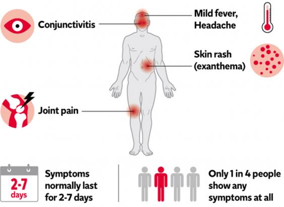 zika-2